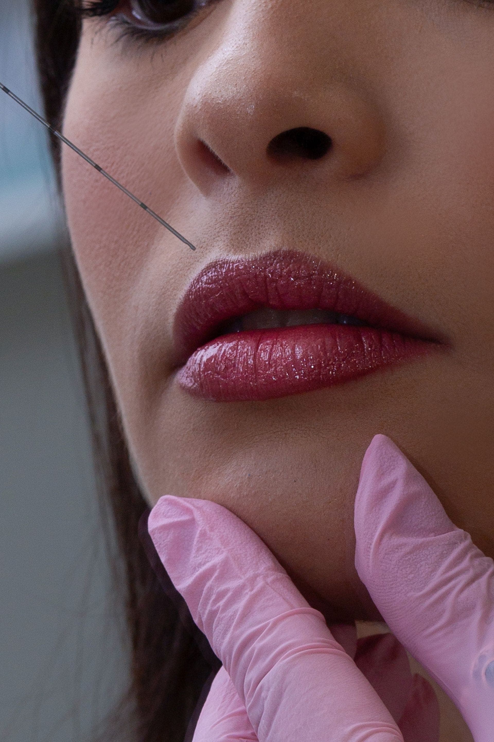 Modelowanie ust, zabieg w Velora Clinic